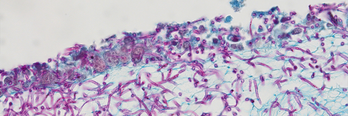 Epithelial infection model