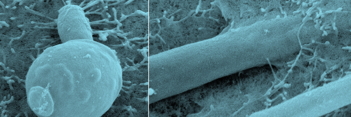 Invasive growth of Candida albicans